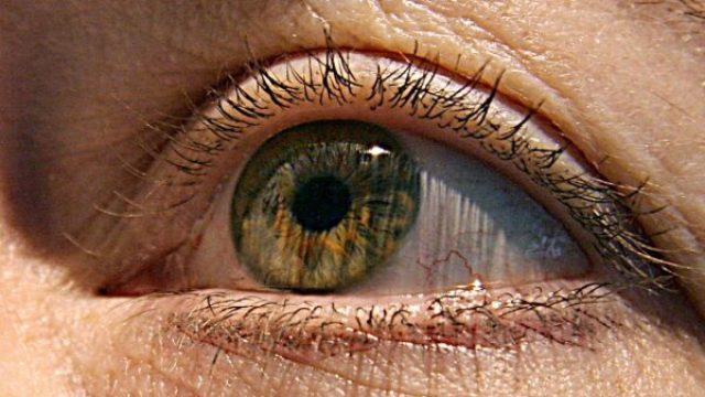 New Drug Approval Shakes Up Thyroid Eye Disease Treatment Landscape | 9club slot, abangda slot 88
